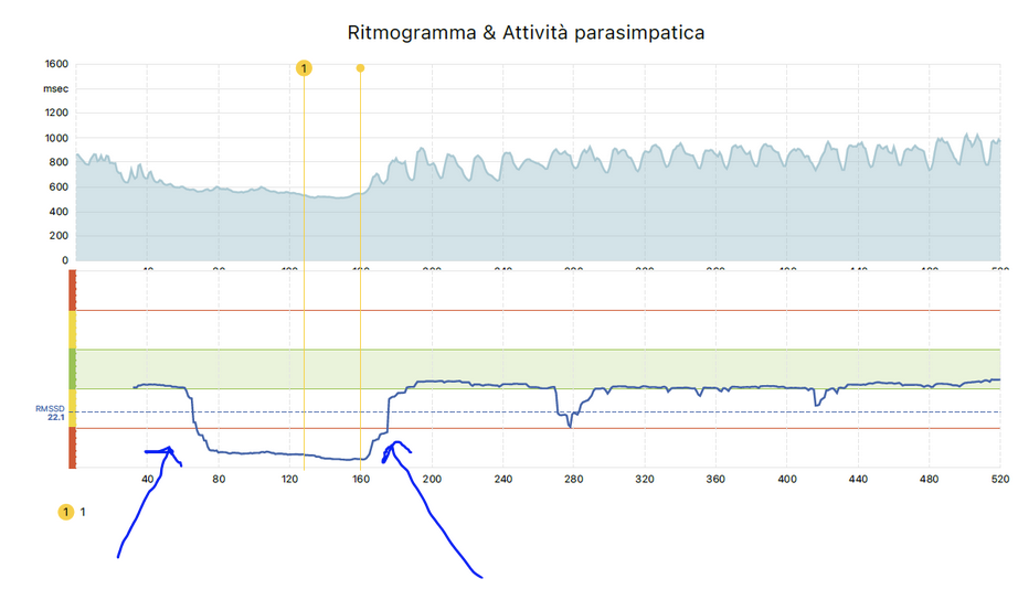 Graphique arythmie sinusale respiratoire d’un stagiaire