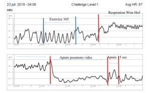 Impact de la respiration Wim Hof sur la cohérence cardiaque